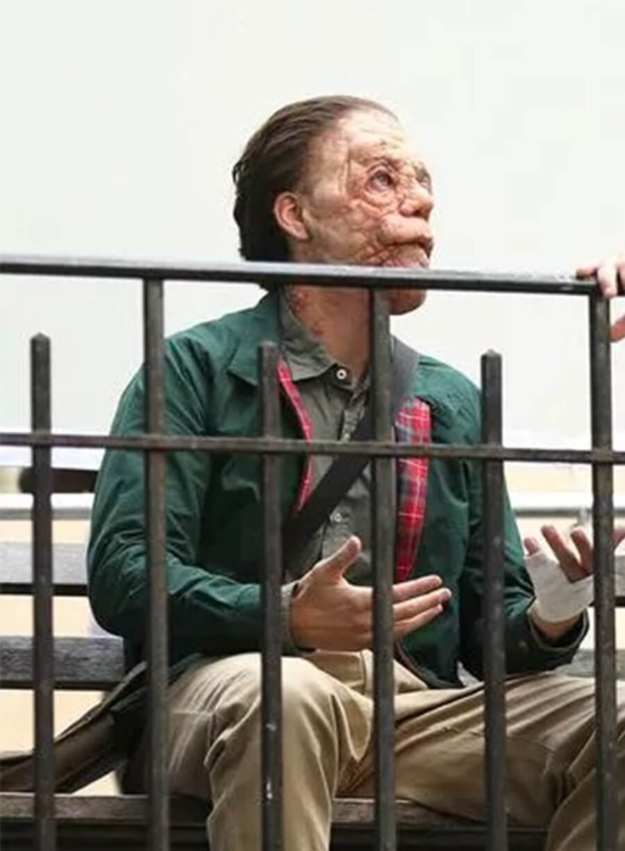 A different Man Adam Pearson Oswald Green Jacket 